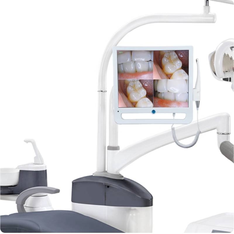Dental intraoral camera 17 inch made in China