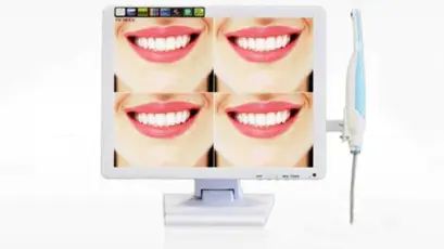 How to choose a cost-effective Intra Oral Camera?