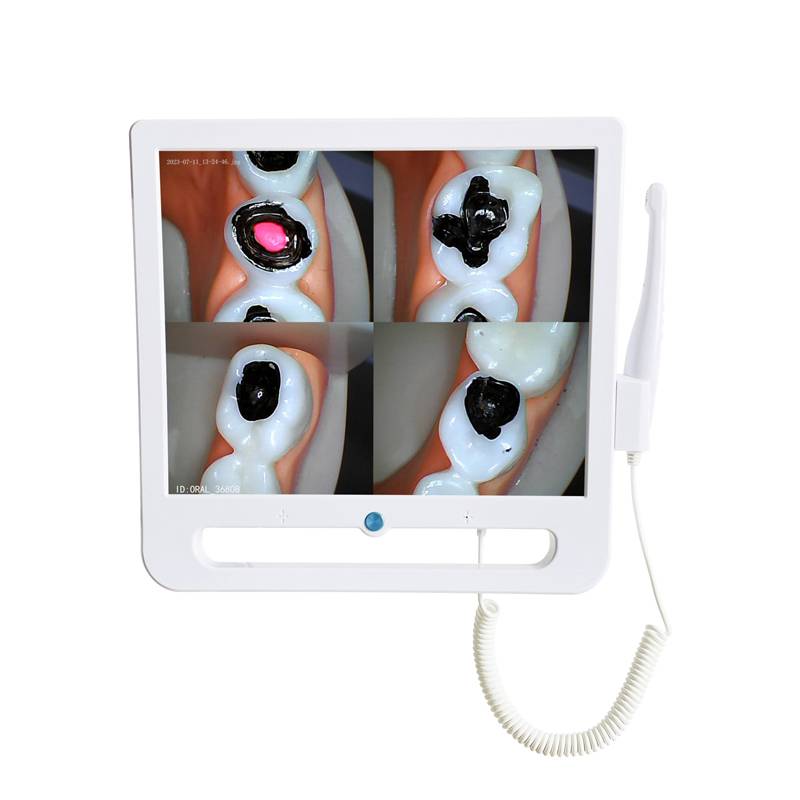 Rundental intraoral camera with 17 inch HD screen