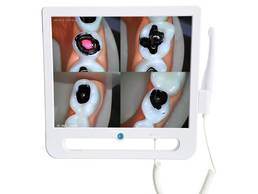Dental Intraoral Camera with HD 17 Inch LCD Monitor WiFi function