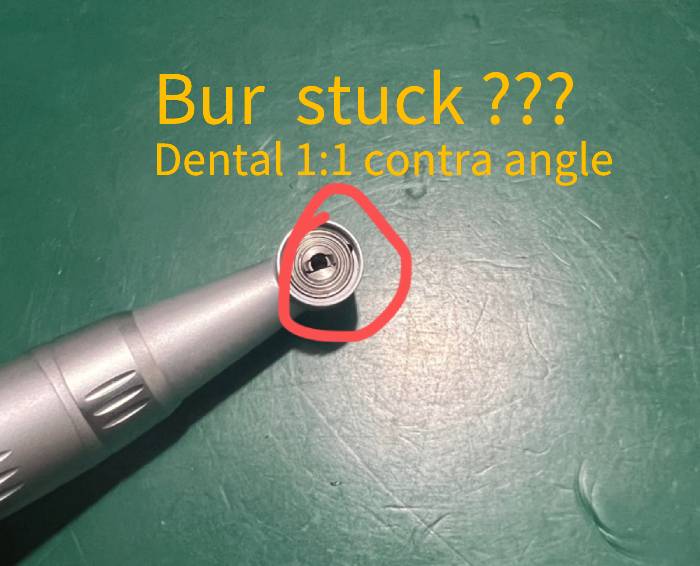 what to do if the bur of 1:1 contra angle is stuck?