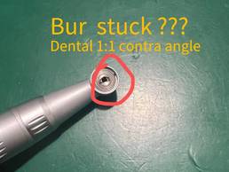 What to do if the Bur of China Dental Handpiece 1:1 Contra Angle is Stuck?