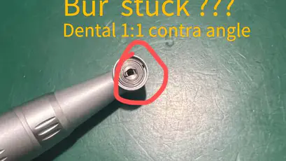 What to do if the Bur of China Dental Handpiece 1:1 Contra Angle is Stuck?