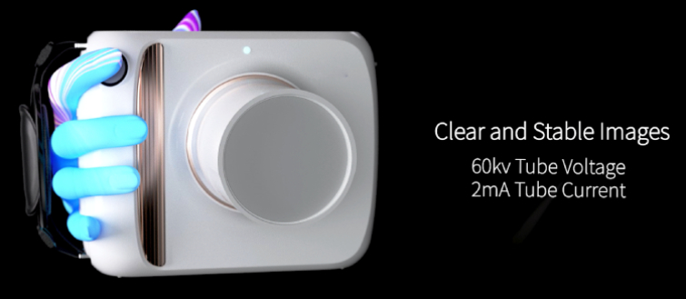 Clear and Stable lmages of Rundental portable x ray machine RX-II