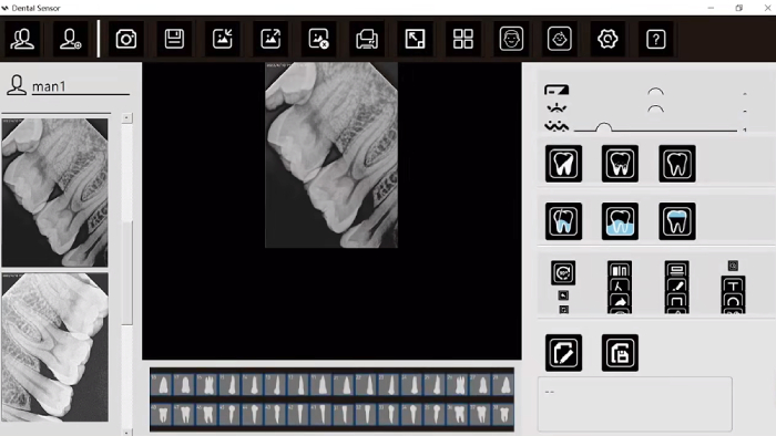 Effect with digital x ray sensor