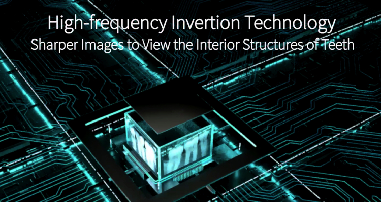 High-frequency lnvertion Technology