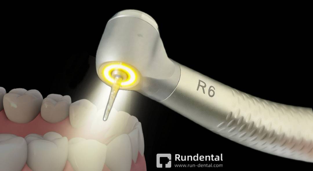 The R6's 360° uniform illumination system provides dentists with a shadow-free working environment