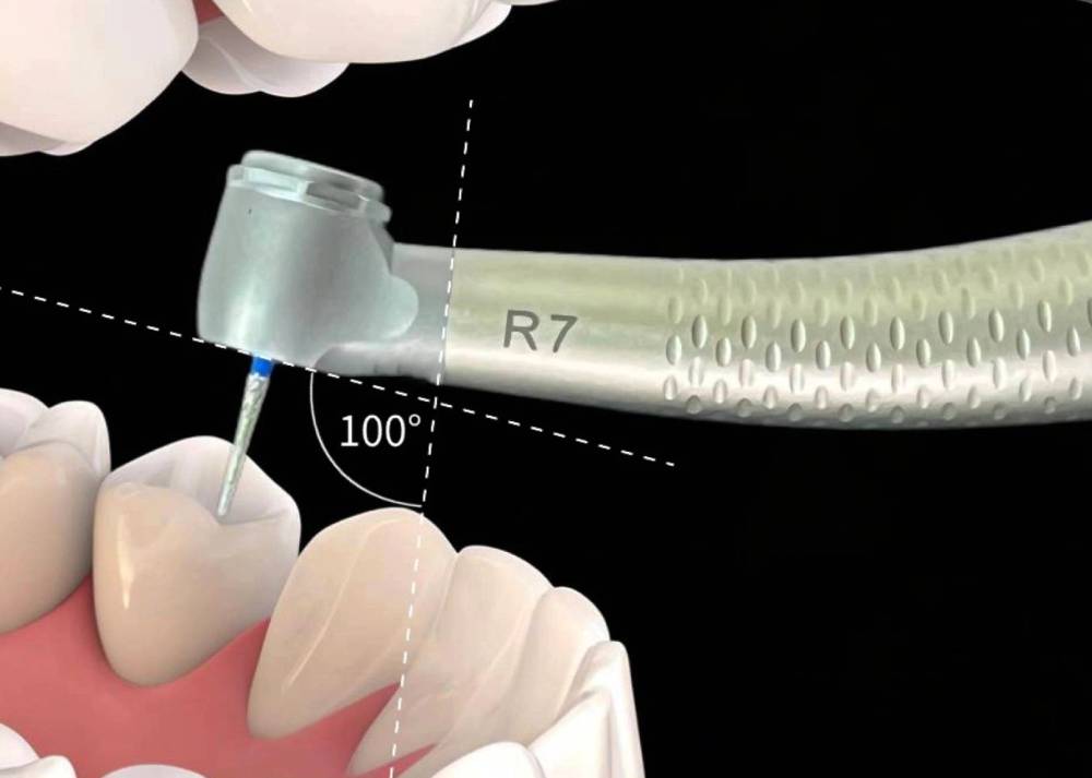 R7 air turbine handpiece with 100 degree angled head